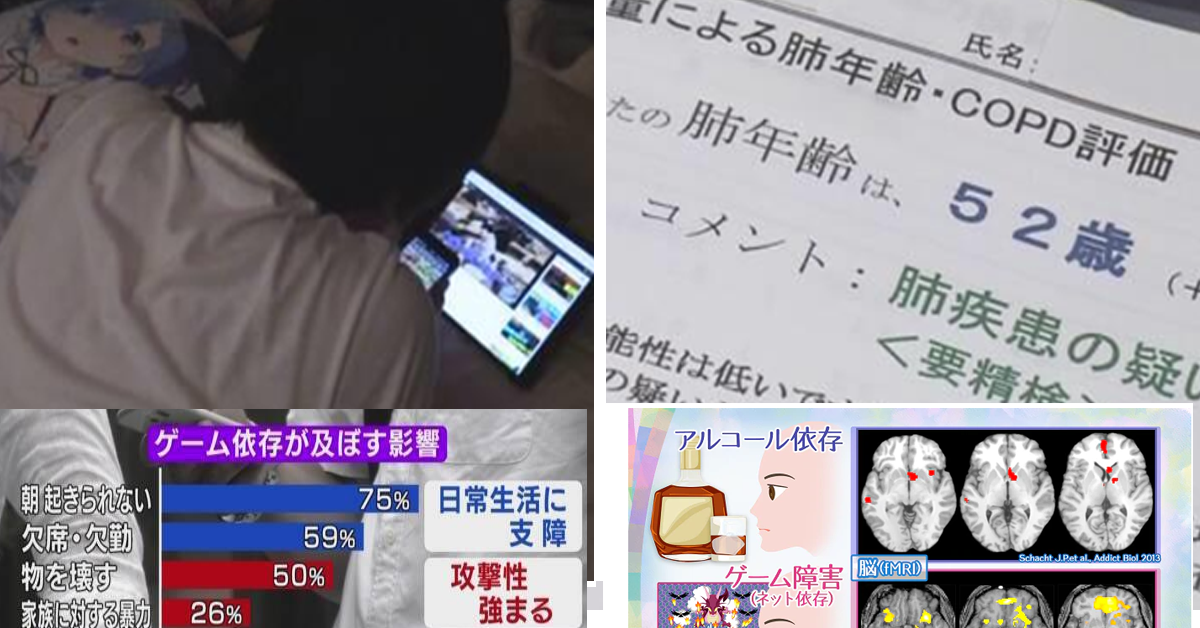 NHK特報：遊戲成癮的居家自閉超越「酒精中毒」　醫院長表示8原因腦部變異...你中了幾項?