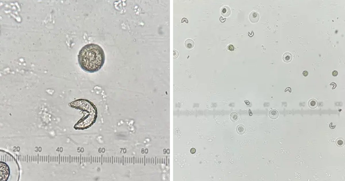 顯微鏡下驚見《小精靈 Pac-Man》的存在引關注  網友 : 沒想到居然是平常惱人的東西！