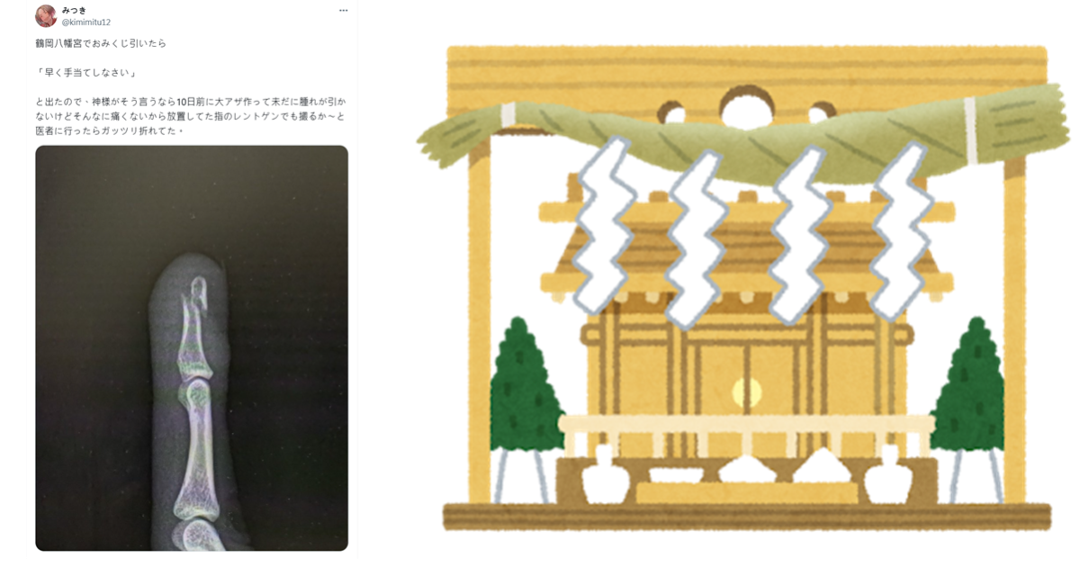 到鶴岡八幡宮求籤寫「快處理吧！」 推主手指紅腫不以為異檢查居然「斷了」讓人驚呼神蹟