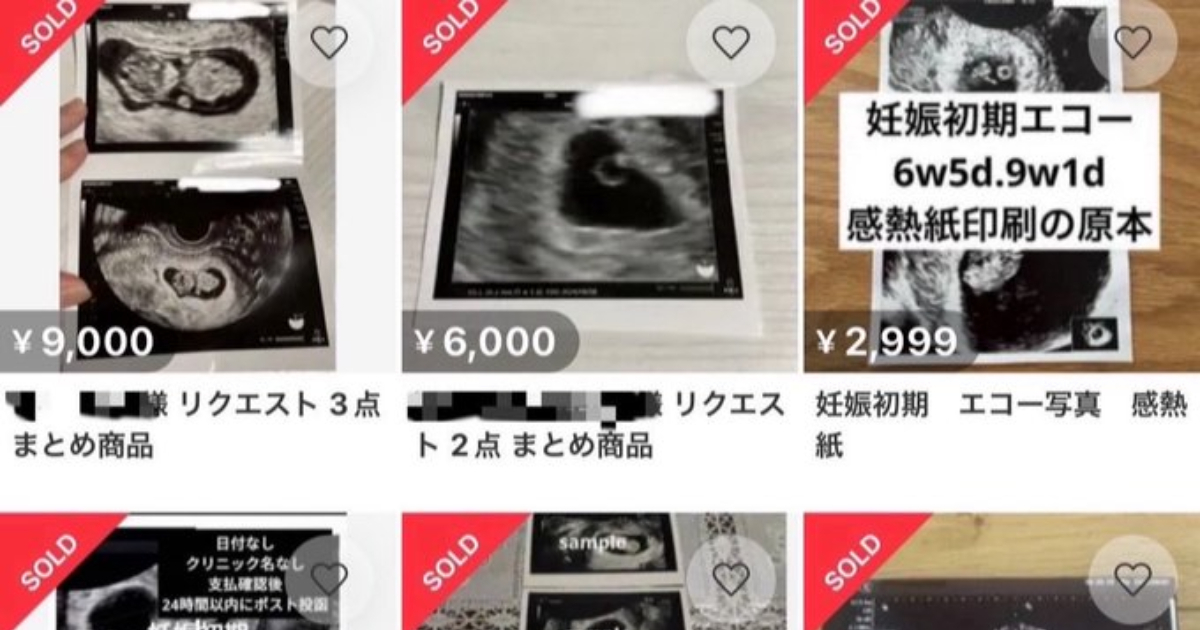 日本網拍居然有人販售「胎兒超音波照」引起網民憤怒  質疑 : 除了「懷孕詐欺」想不到用途...