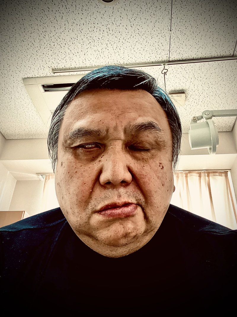 日本海洋堂社長因顏面神經麻痺入院半月 恢復神速還在病房裡組模型