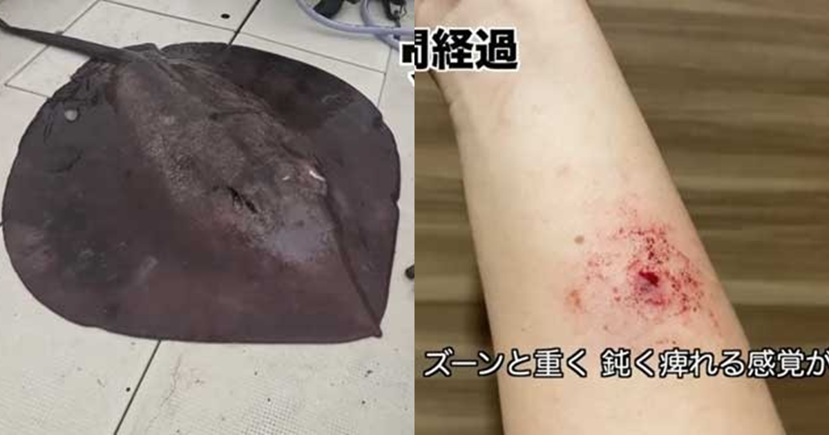 日本YouTuber意外遭到巨大深海魚的毒刺刺傷手臂　五個小時後身體出現驚人變化