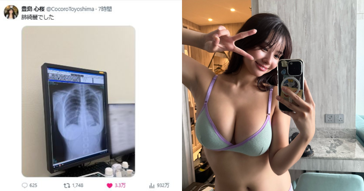 寫真偶像豐島心櫻上傳胸部X光照 浮現的胸部線條讓網友直喊：沒想過連X光都這麼色... 