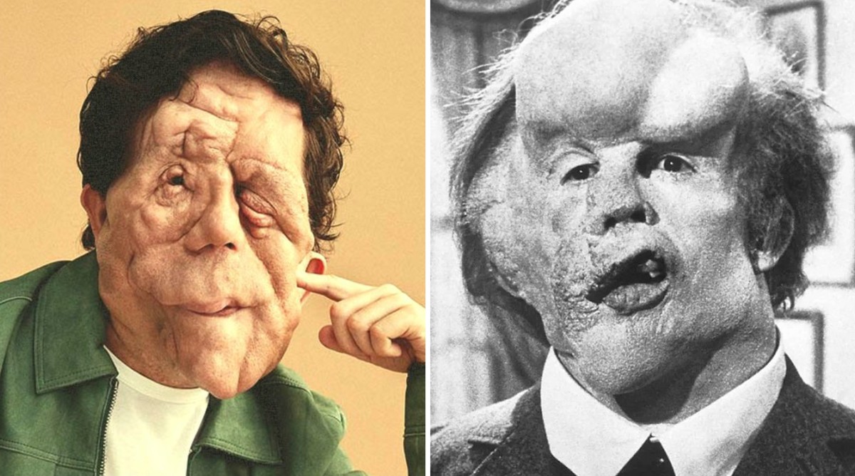 Classic Film "The Elephant Man" Gets Remake; "Downfall" Director Oliver Hirschbiegel to Helm